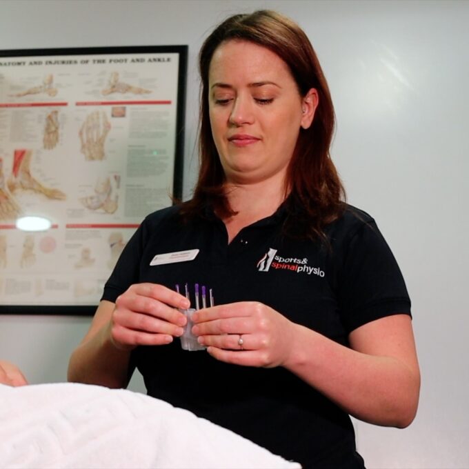 Acupuncture Relieve Muscle Tension Brentwood Essex